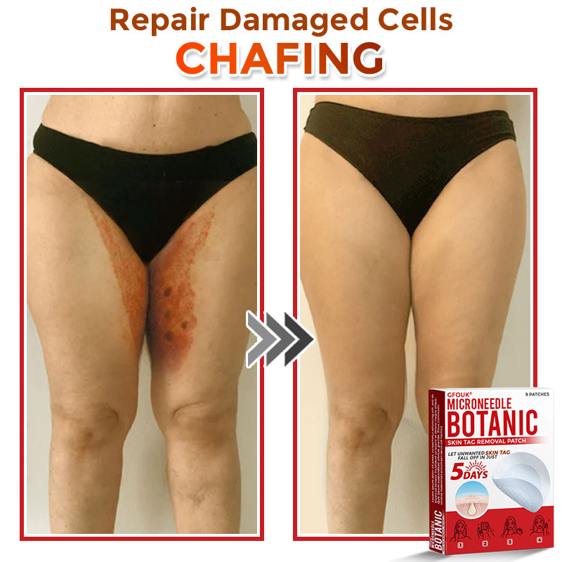 🌈GFOUK® MicroNeedle Botanic Skin Tag Removal Patch 🇺🇸 Made in the USA